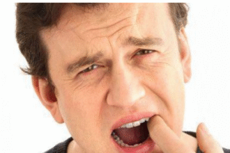 Food Stuck in Wisdom Tooth Hole